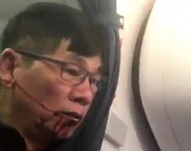 United Airlines bồi thường "khủng" cho bác sĩ Dao